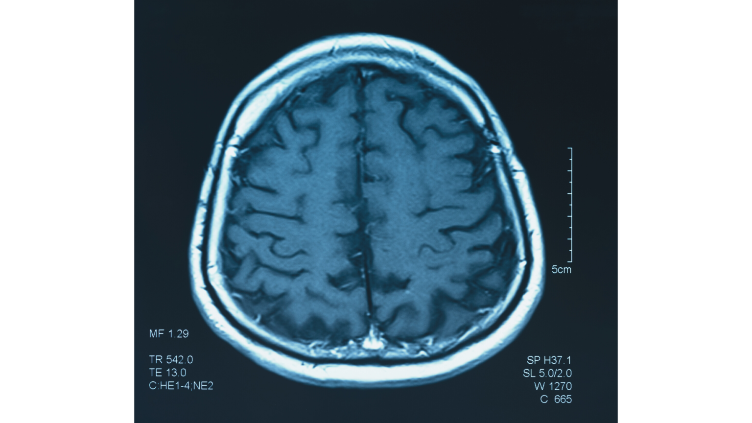 self-directed-neuroplasticity-how-to-change-your-brain-for-the-better