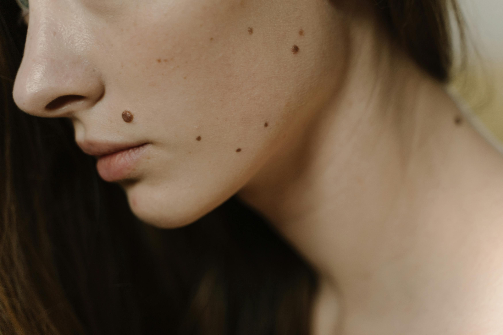 Understanding the Importance of Regular Mole Mapping Checkups 1 AD 4nXd SmQafSluQZm36x1WVkZ rt pT5aVCgWiuAxzcVZt6yK0hkqudPaC6gBpvJQekaaq9lYJLkvrRQF7KYDHP1Q0eoUM63 uuoC45DVeiKkSprX2 msytRoOhw9zYq1qVUc0JUwE0w